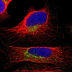 COA1 Antibody, Novus Biologicals 0.1 mL | Buy Online | Novus Biologicals | Fisher Scientific